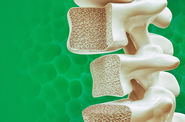 Интегративный подход к проблеме остеопороза. Остеосаркопения как новое системное заболевание. Генетические детерминанты остеопороза, биомаркеры и основные механизмы развития. Возможности современной диагностики, профилактика и лечение.