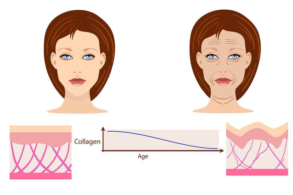 Типы старения человека | Anti-Age Expert