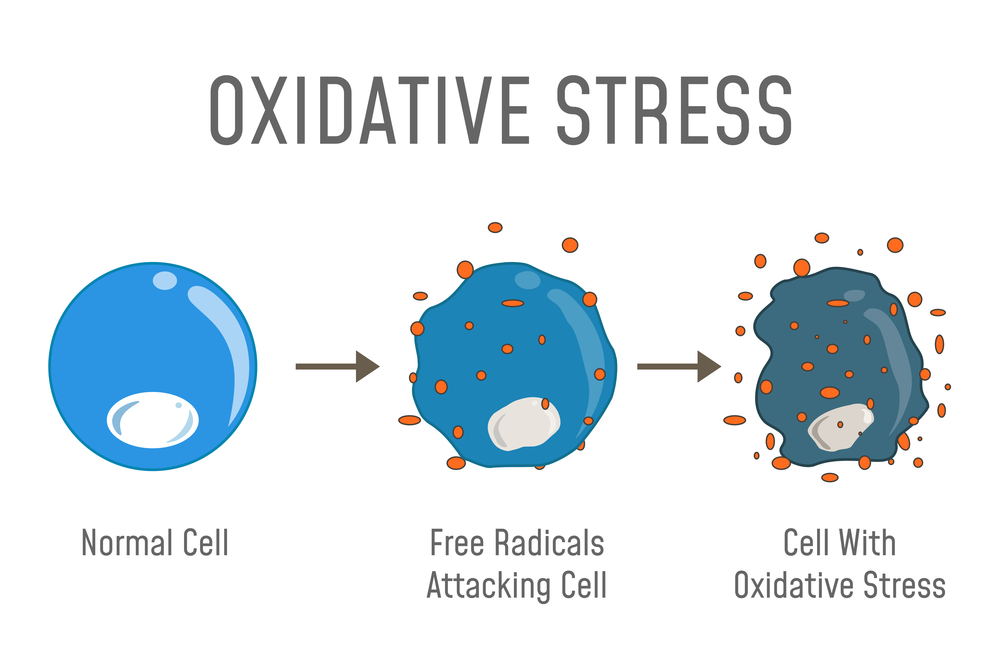 оксидативный стресс